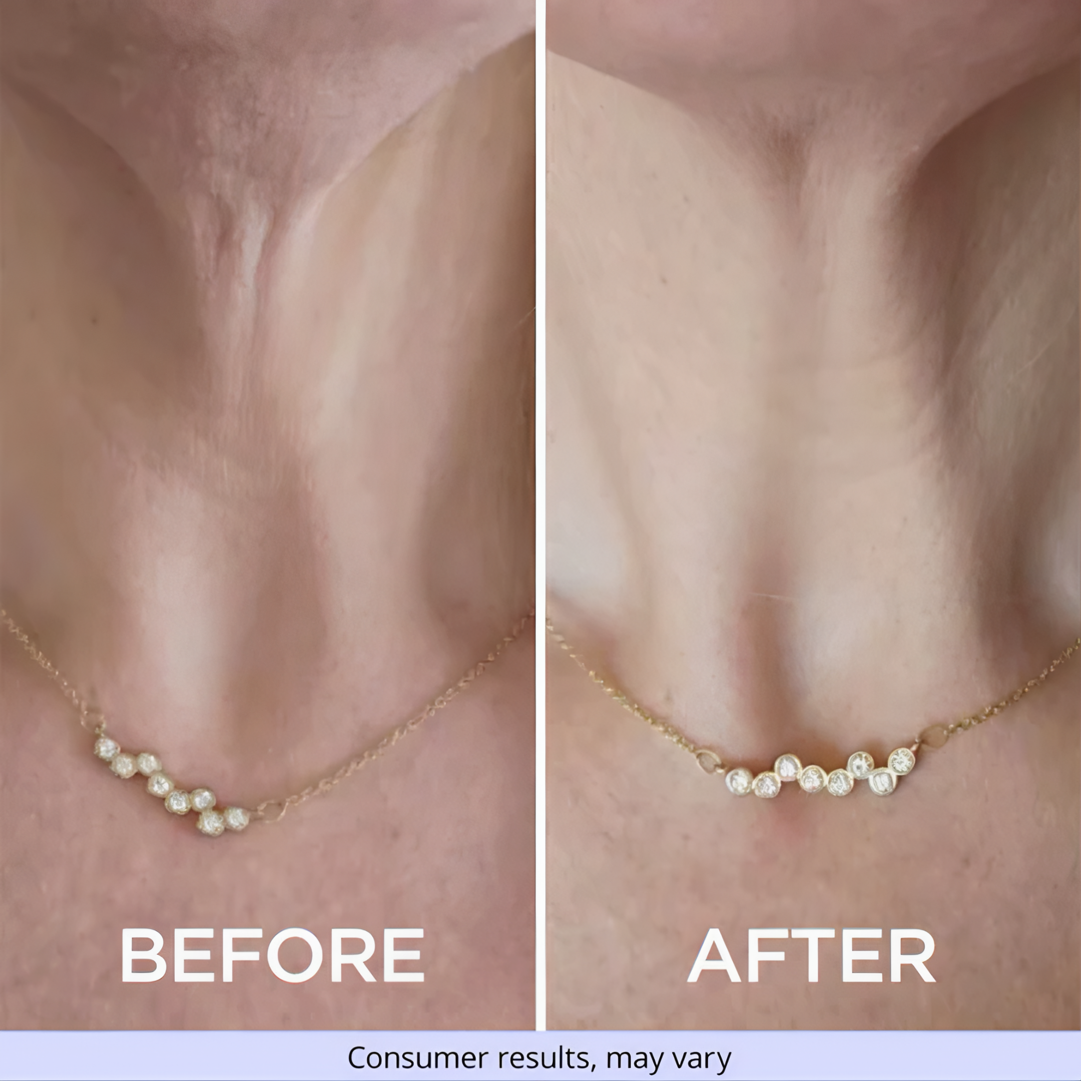 Tighten & Lift Neck Cream